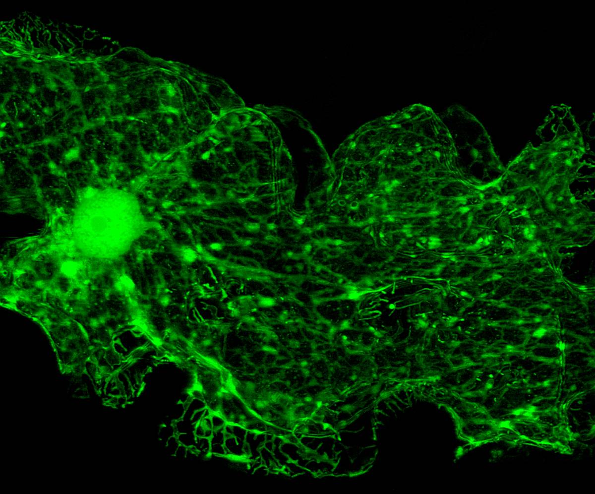 Anesthesia and Myocardial Ryanodine Receptors 
