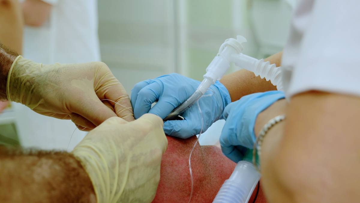 Types of Emergency Airway Access