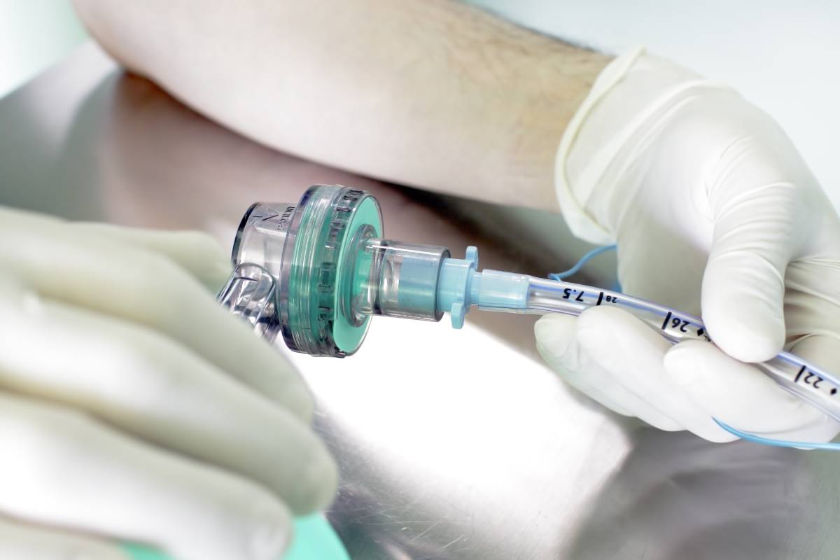 Patient Discomfort and Hemodynamic Response during Extubation