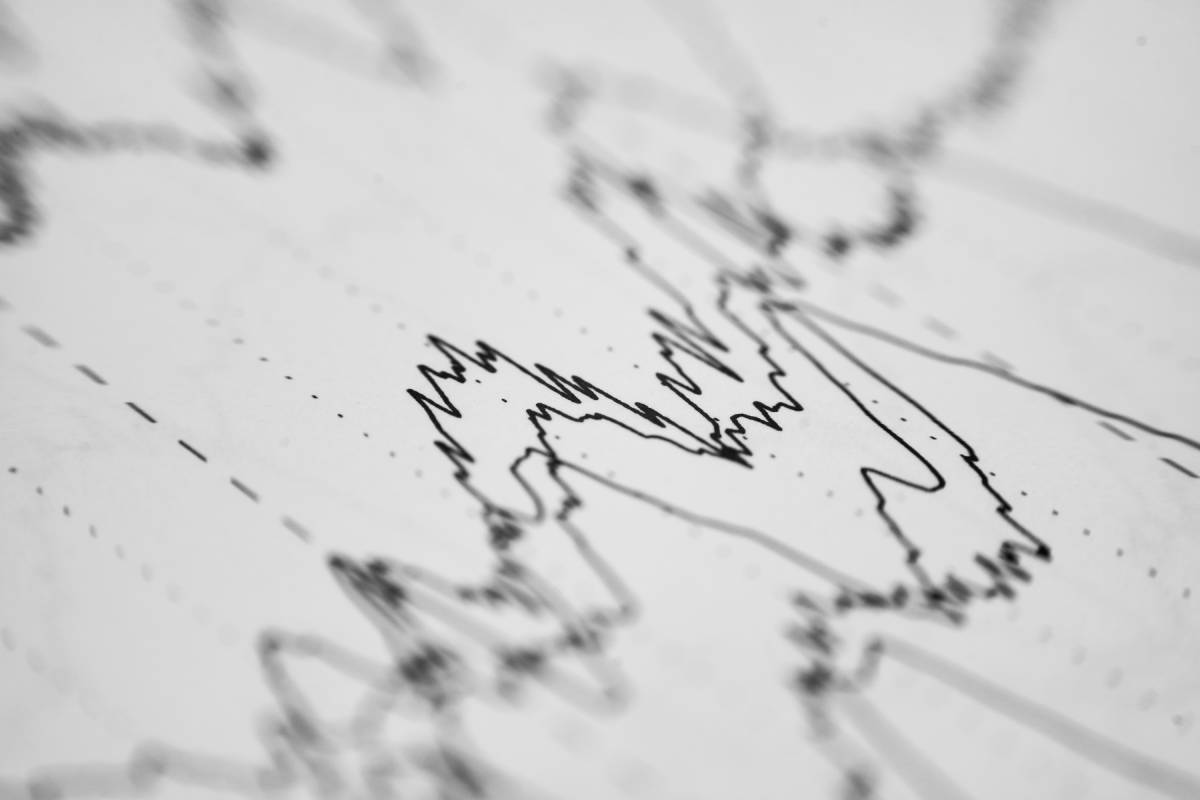 Perioperative Considerations for Patients with Seizures