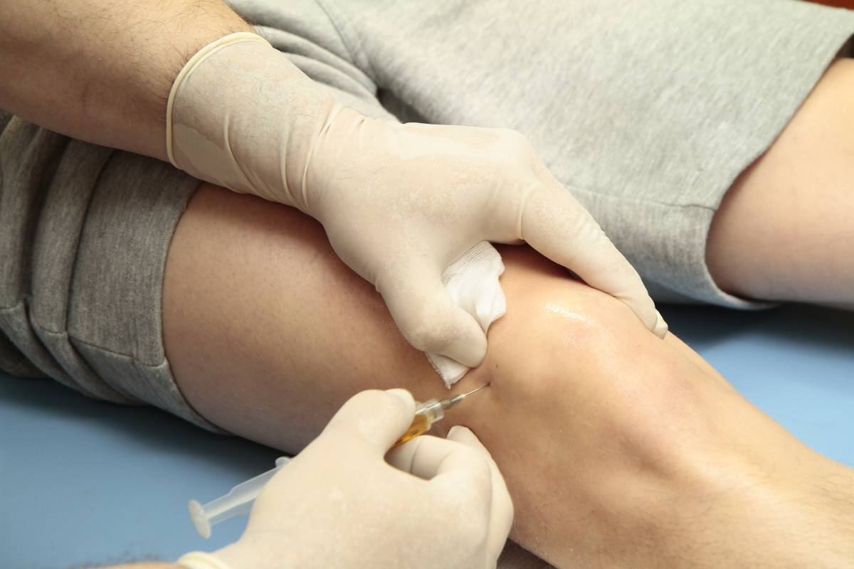 Overview of Popliteal Nerve Blocks