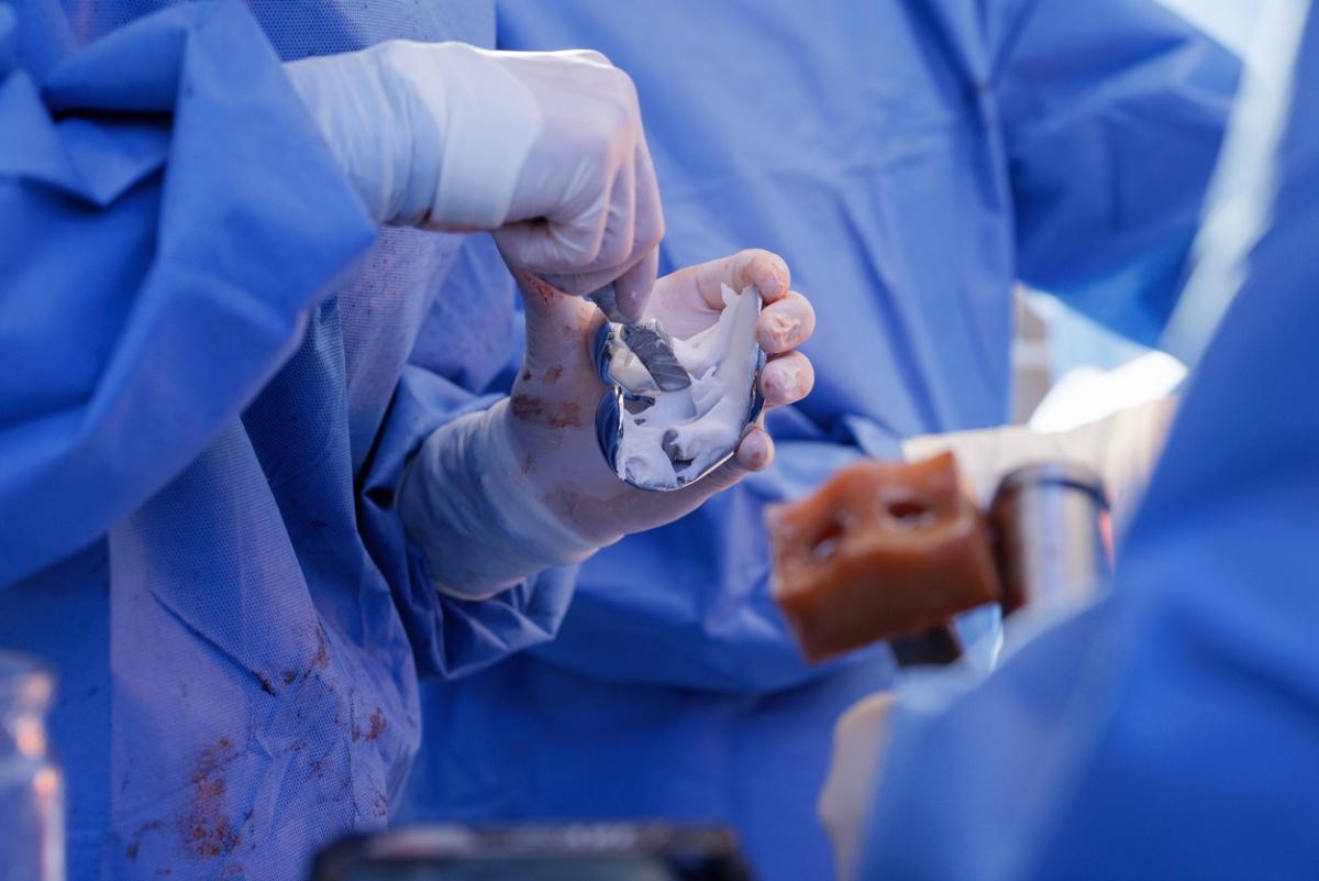 Tourniquet-Free Total Knee Arthroplasty